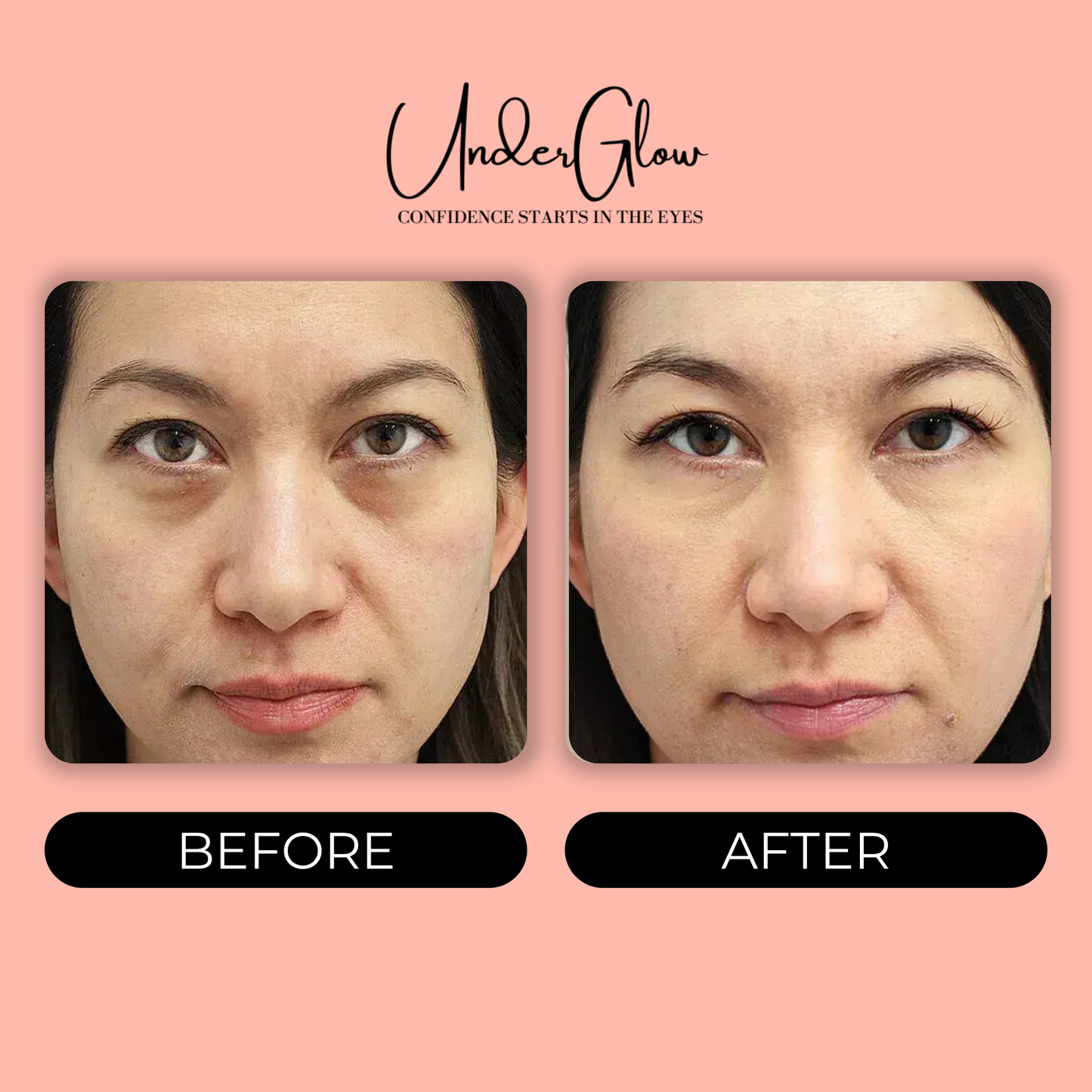 UnderGlow™ Red Light Under Eye Therapy Glasses