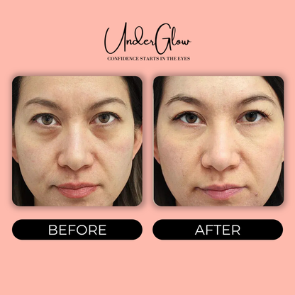 UnderGlow™ Red Light Under Eye Therapy Glasses